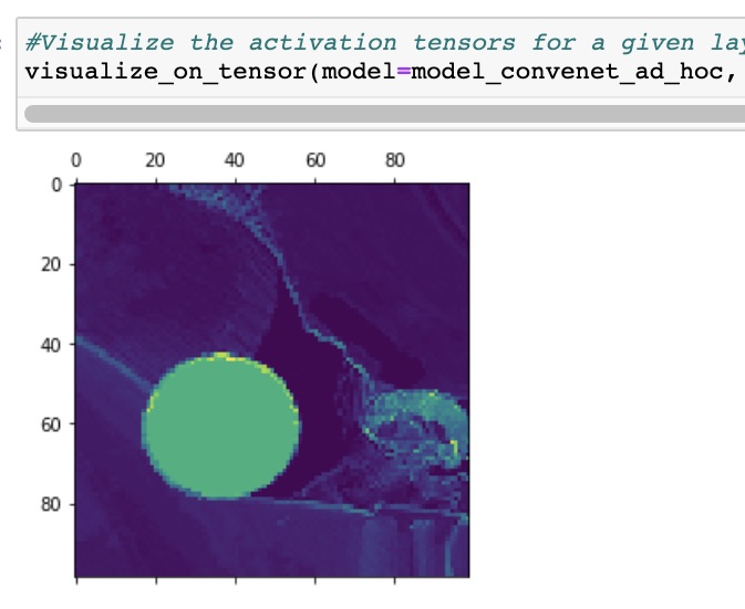 On the extracted feature on the bottom layer from the L picture with ellipse. We see in green the activated regions. The ellipsis is strongly activated but also the pacifier.